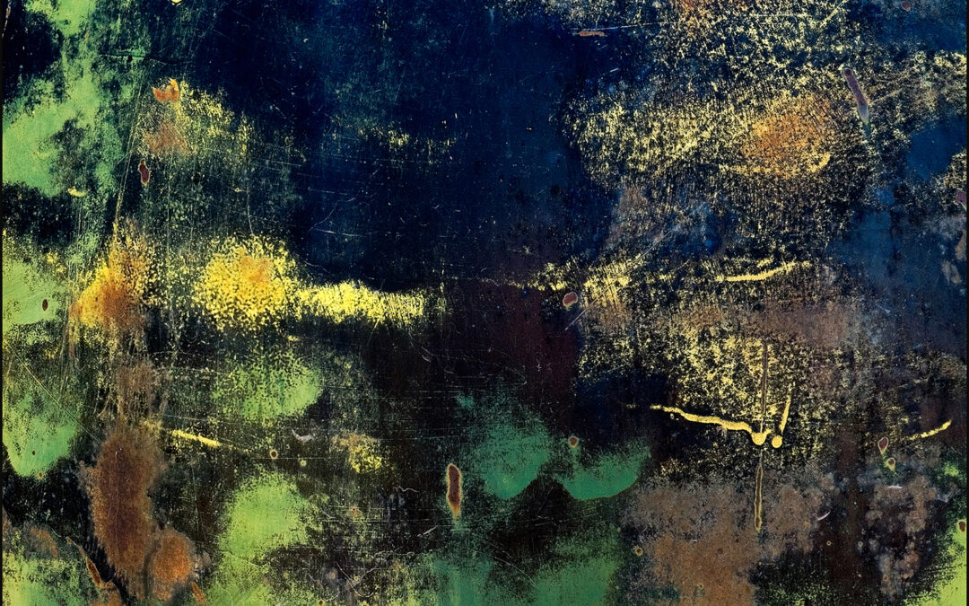 Dead Skin Cells by Jacob Weil